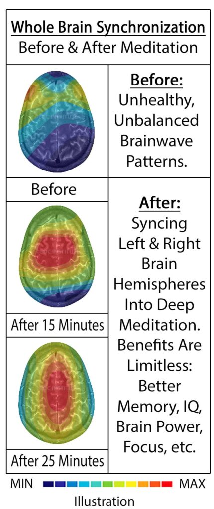 meditation for anxiety